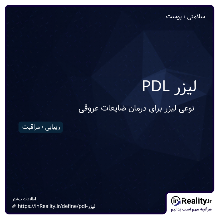 توضیح کوتاهی از PDL لیزر به تصویر