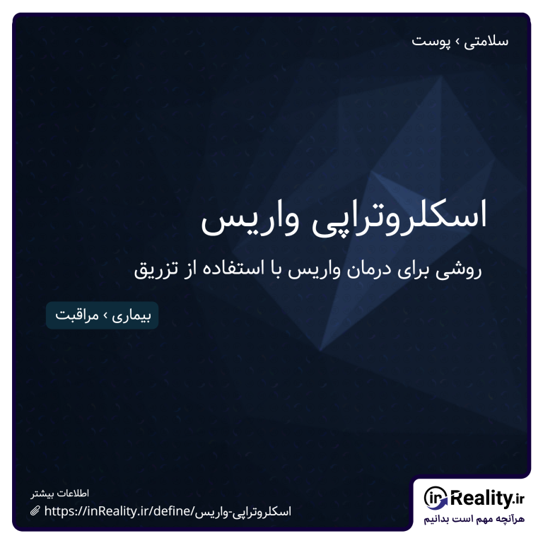 توضیح کوتاهی از اسکلروتراپی واریس به تصویر