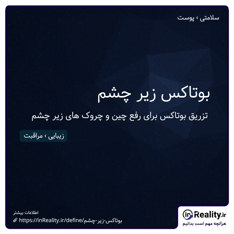 توضیح کوتاهی از بوتاکس زیر چشم به تصویر