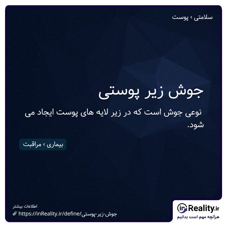 توضیح کوتاهی از جوش زیر پوستی به تصویر