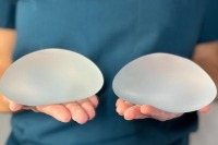 بررسی انواع سایز پروتز سینه